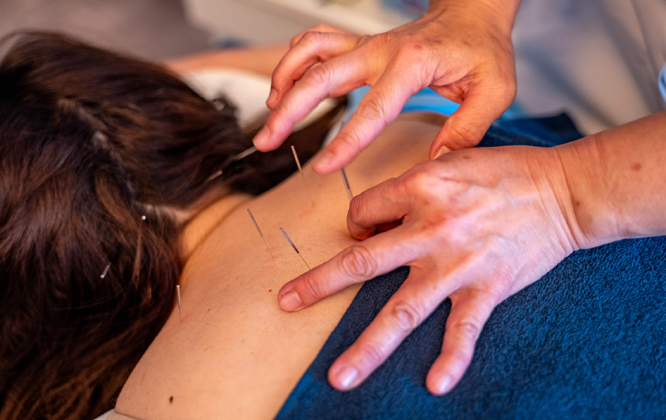 鍼灸