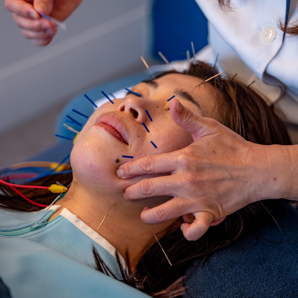 美容鍼灸